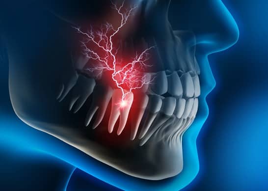When Coming In For A Dental Emergency
