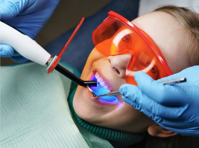 A young patient getting dental sealants at Lifeway Dental