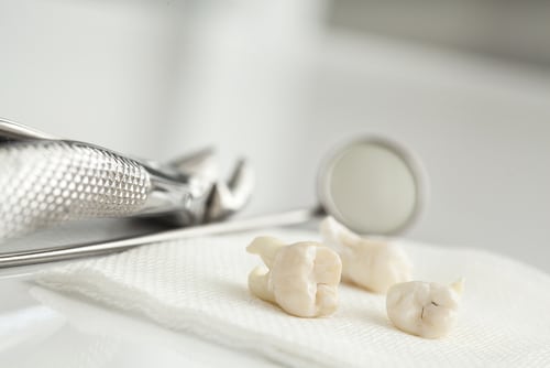 removed,wisdom,tooth,on,white