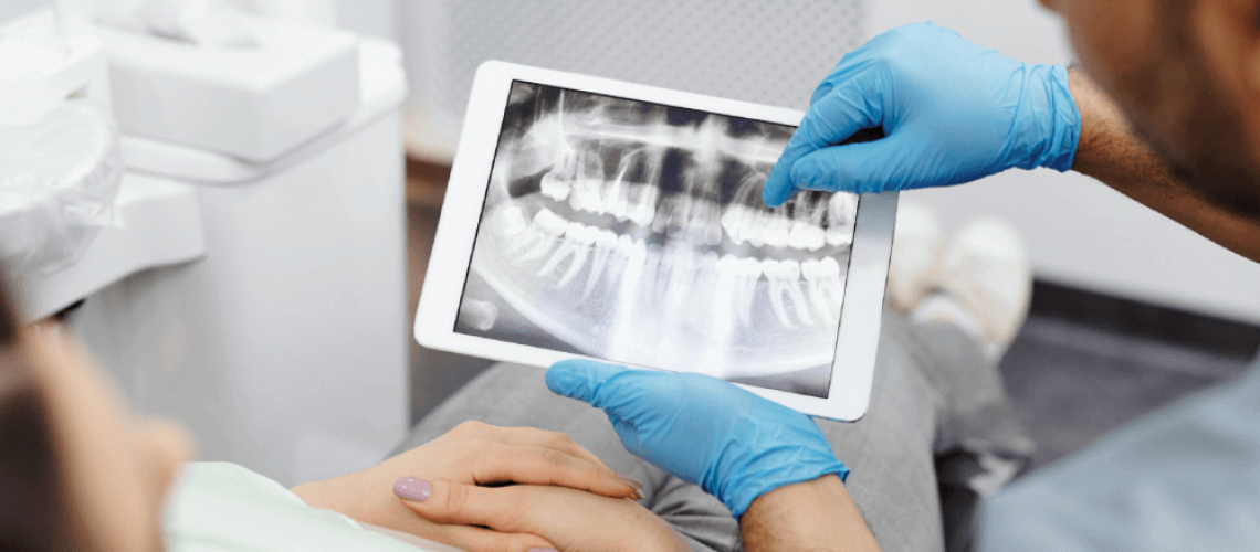 An Alvarado dentist showing a patient their dental x-rays